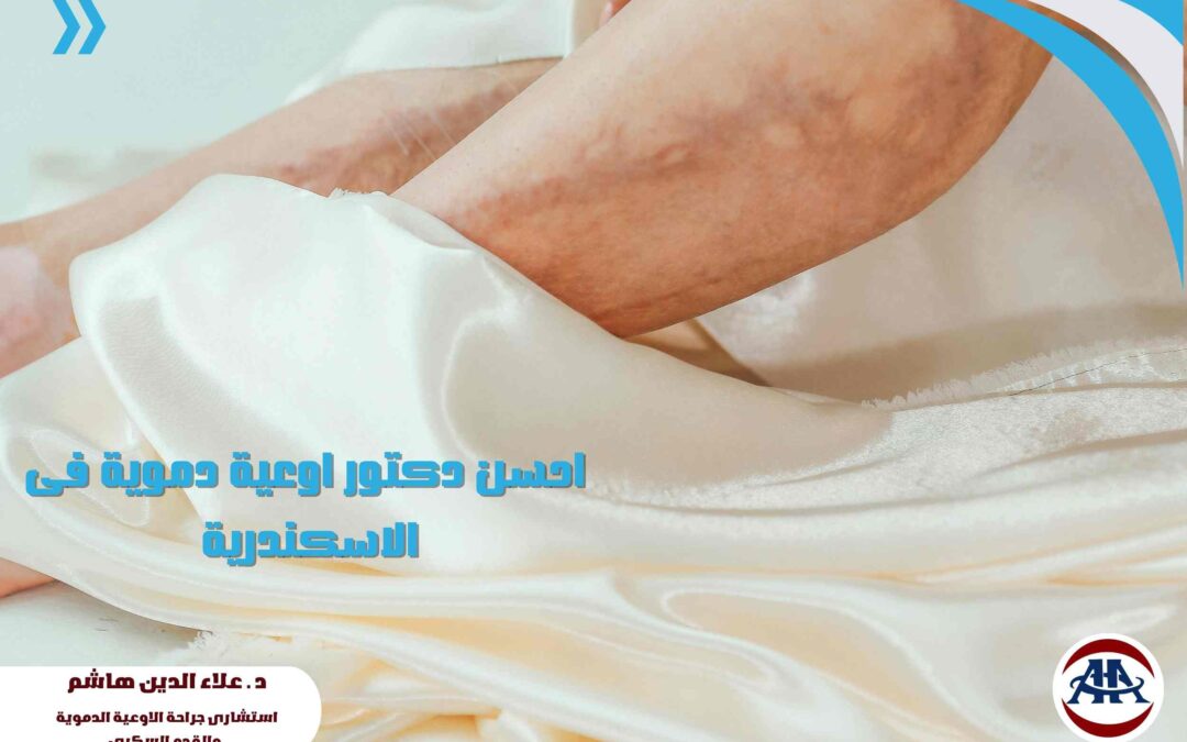 احسن دكتور اوعية دموية فى الاسكندرية