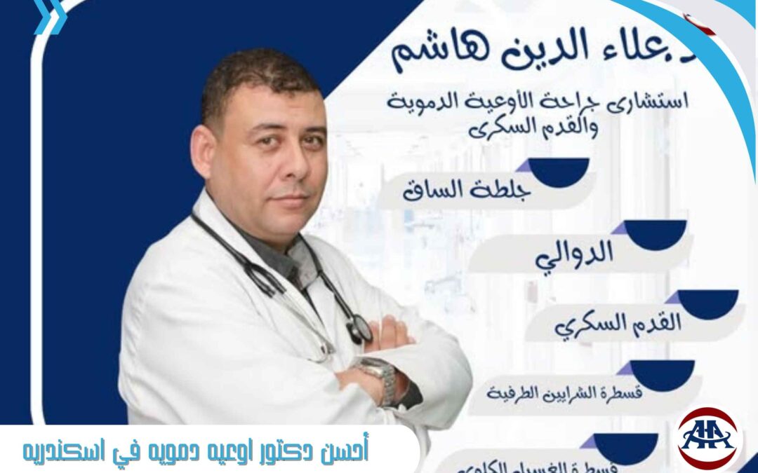 أحسن دكتور اوعيه دمويه في اسكندريه