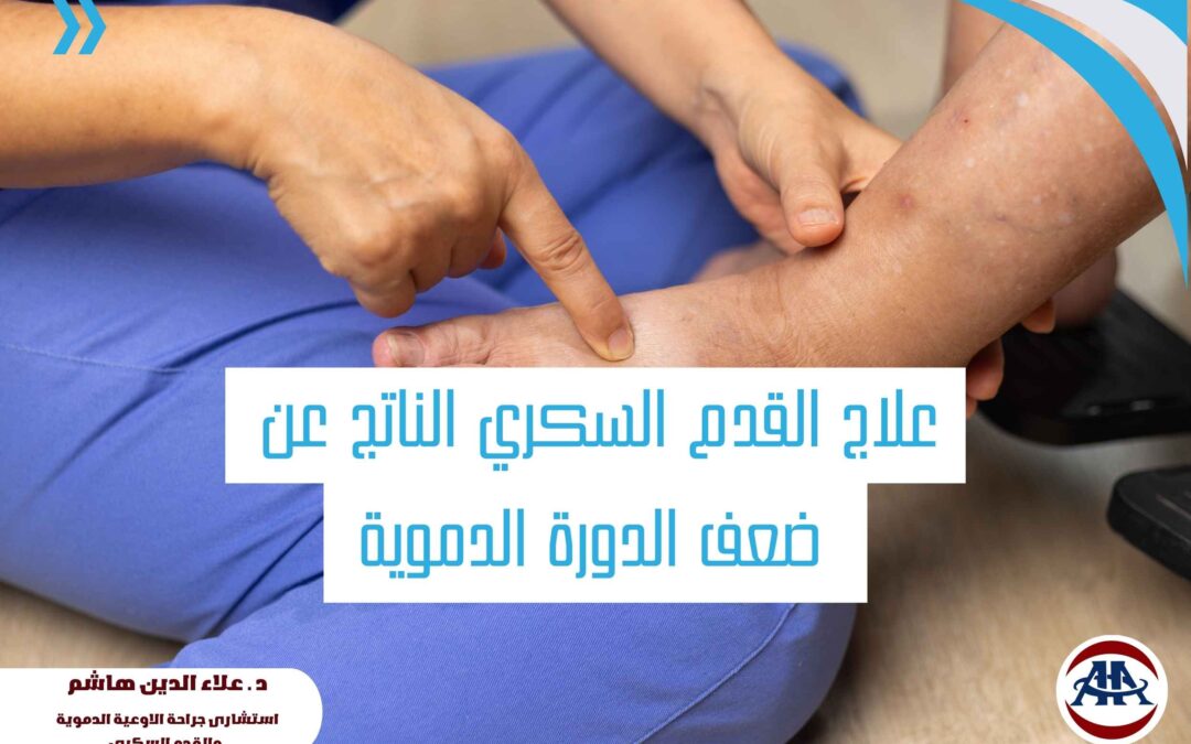 علاج القدم السكري الناتج عن ضعف الدورة الدموية