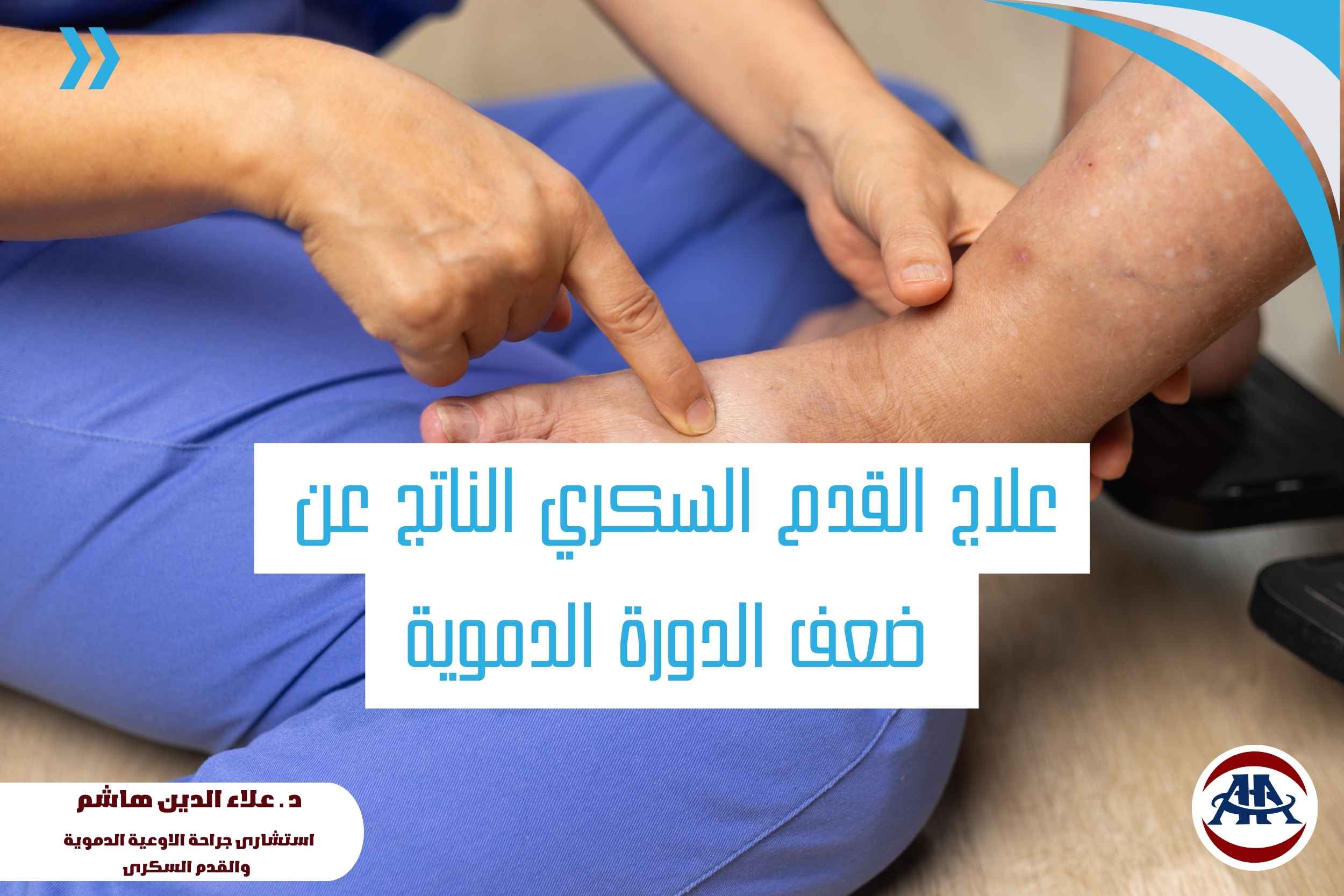 علاج-القدم-السكري