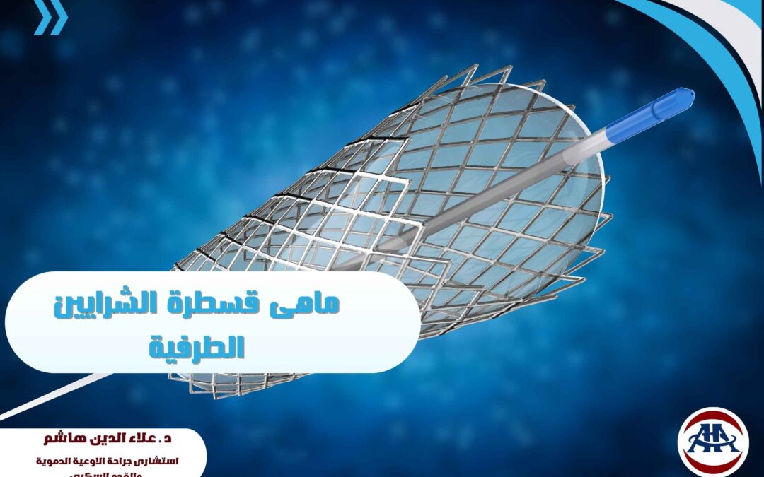 ما هى قسطرة الشرايين الطرفية؟